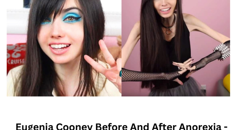 Eugenia Cooney Before And After Archives - Celeb And Crime Gists