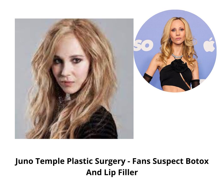 Juno Temple Plastic Surgery - Fans Suspect Botox And Lip Filler