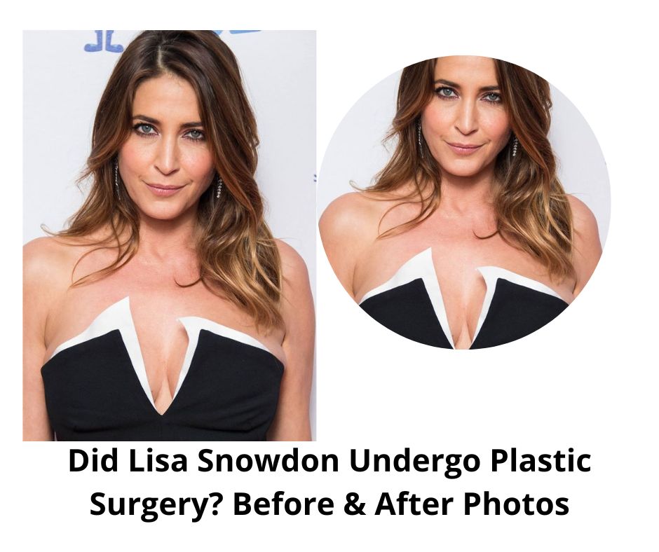 Did Lisa Snowdon Undergo Plastic Surgery? Before & After Photos: Did She Lose Weight Due To An Illness?