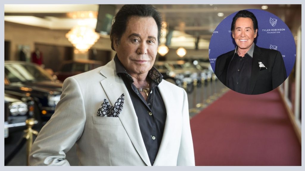 Has Wayne Newton Done Face Lift Plastic Surgery?